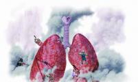 全球肺癌关注月，预防肺癌从这几个习惯做起