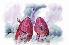 全球肺癌关注月，预防肺癌从这几个习惯做起